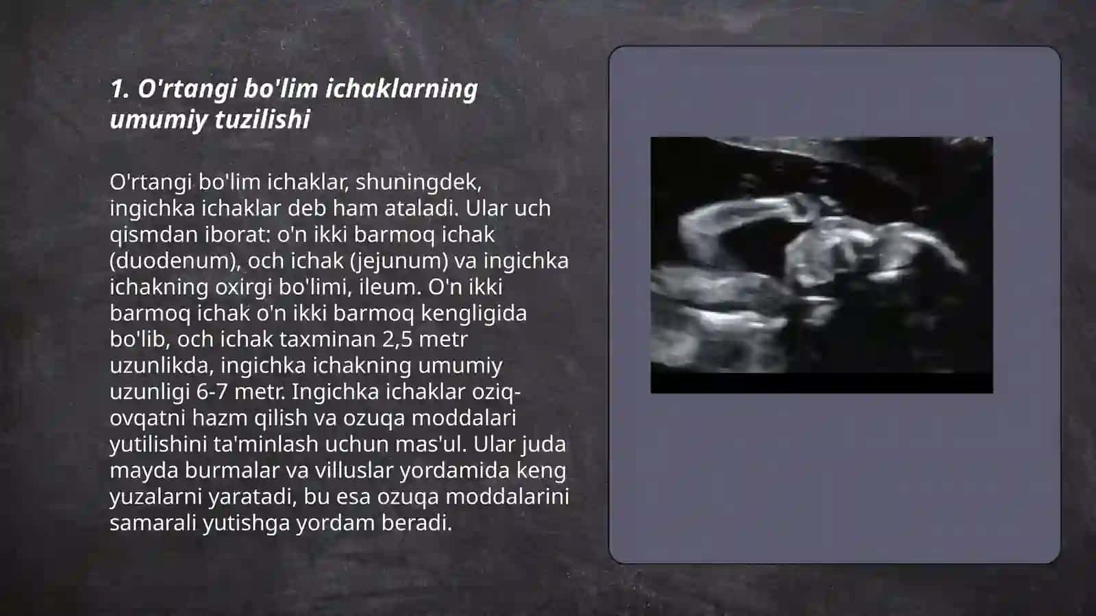 O'rtangi bo'lim ichaklarining anatomik tuzulishi va topografiyasi 3