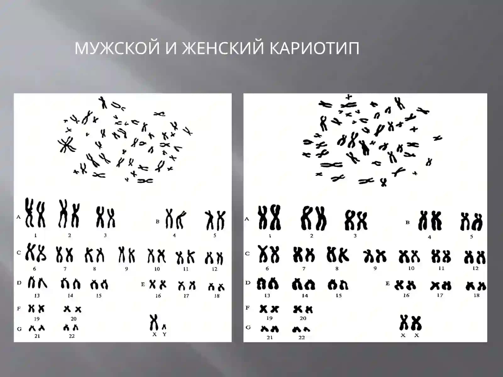 Цитогенетический метод исследования. Болезни, связанные с изменением количества и качества хромосом. МУЖСКОЙ И ЖЕНСКИЙ КАРИОТИП 3