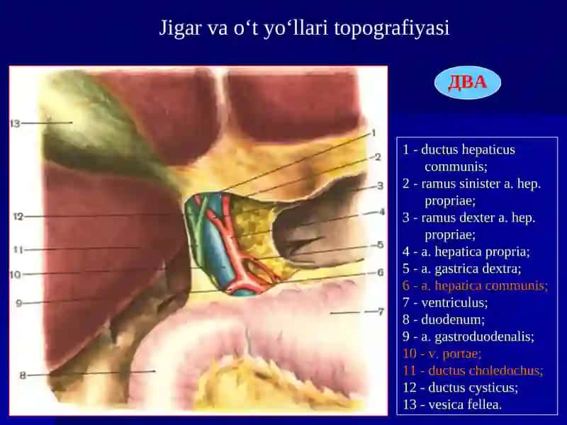 O‘tkir xolesistit va uning asoratlari 3