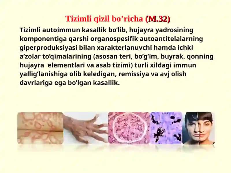Tizimli Qizil Bo’richa 3