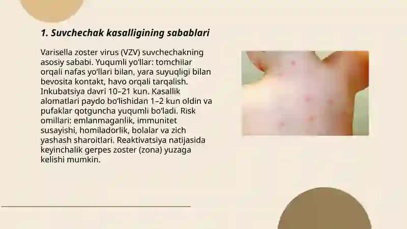 Suvchechak kasalligi 3