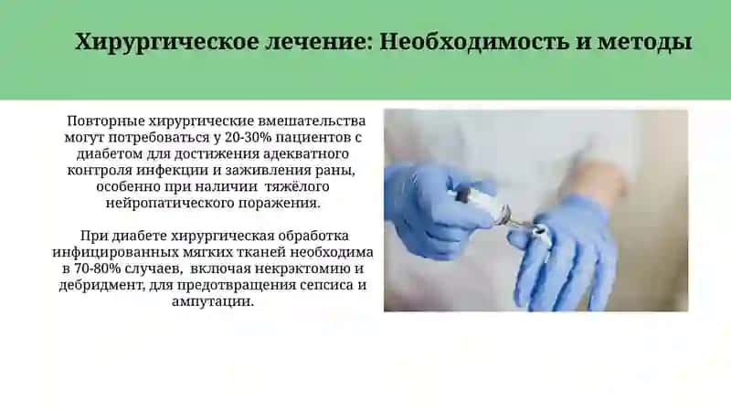 Методы лечения хирургических инфекций мягких тканей у больных сахарным диабетом 3