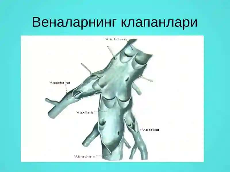 Varikoz kasalligi 3