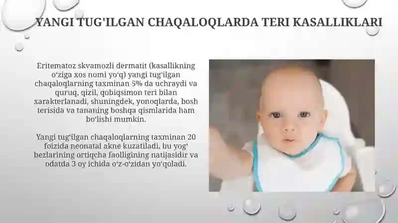 Yangi tug'ilgan chaqaloqlarda teri kasalliklari 3