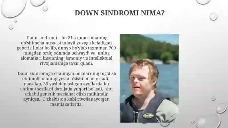 Daun sindromi haqida 3