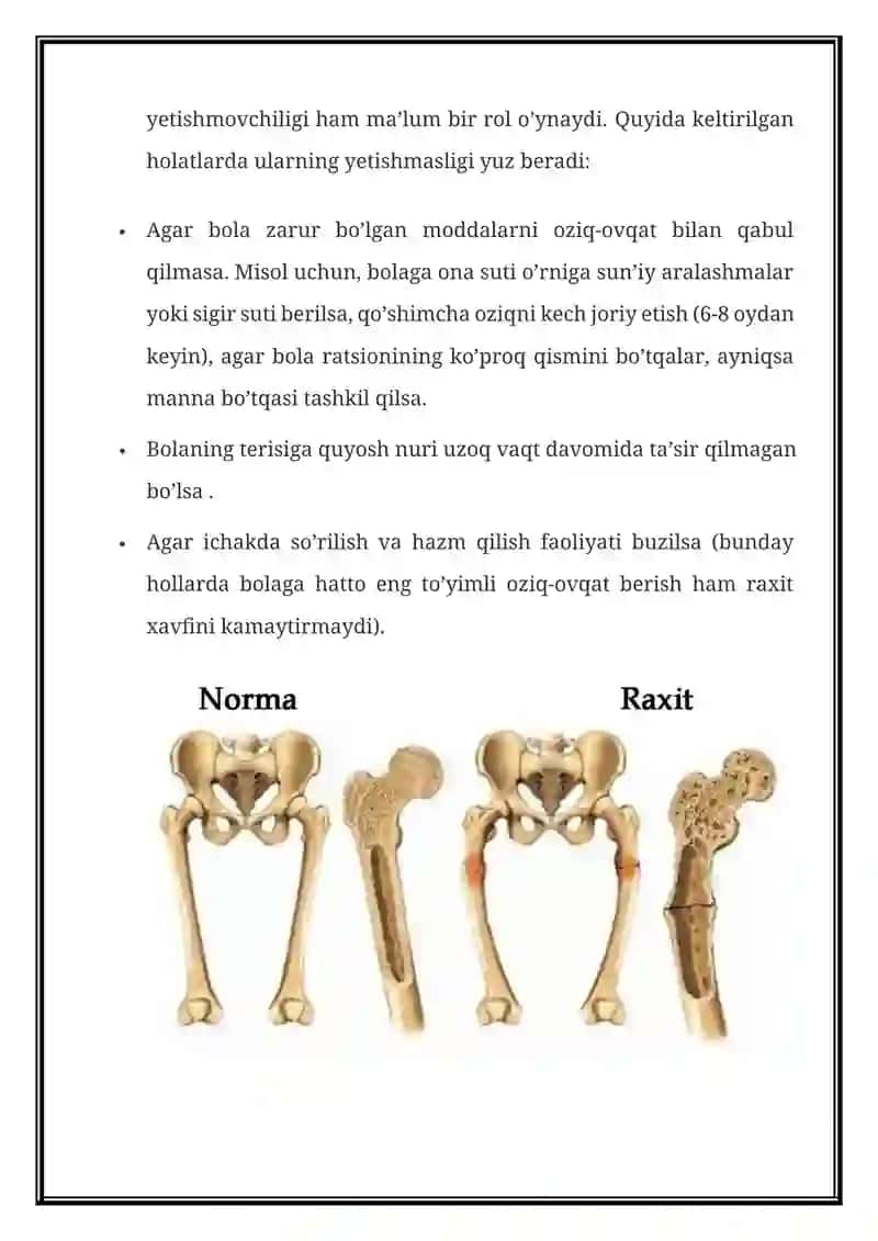 RAXIT — BELGILARI, XAVF OMILLARI, TASHXISLASH, DAVOLASH, OLDINI OLISH 3