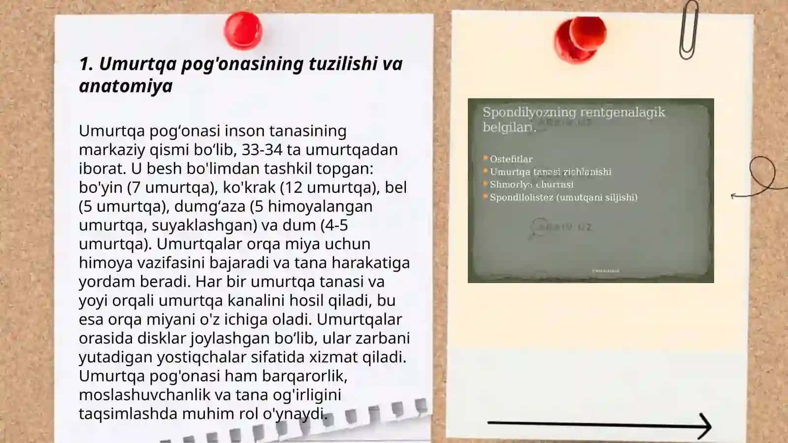 Umurtqa tugʻma anomaliyalari nur tashxisi usullari 3
