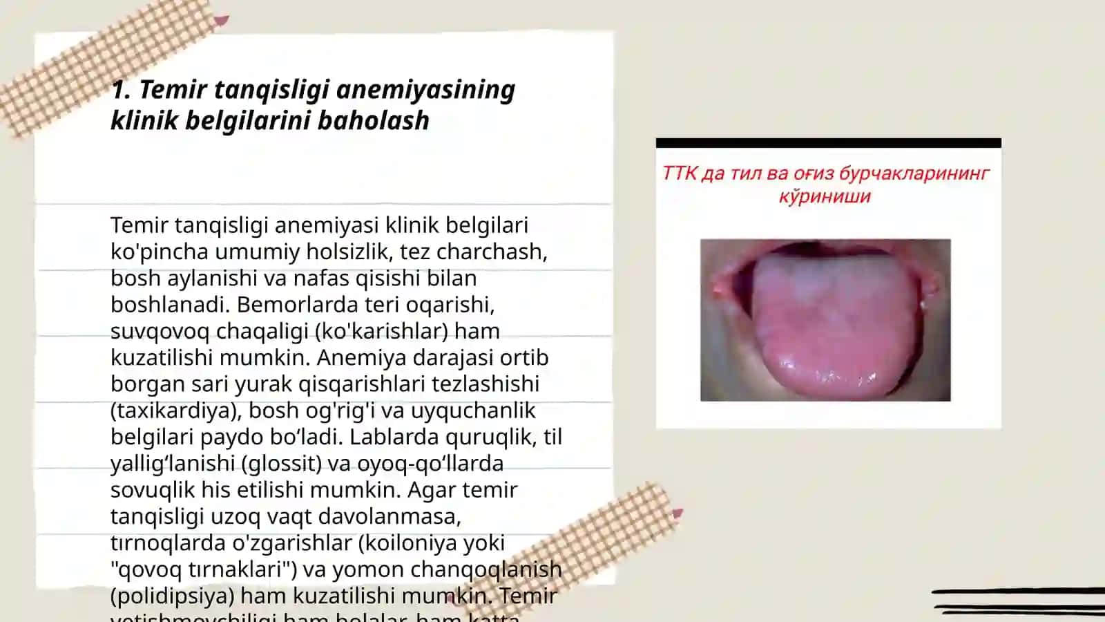 Temir tanqisligi anemiyani differentsial diagnostikasi 3