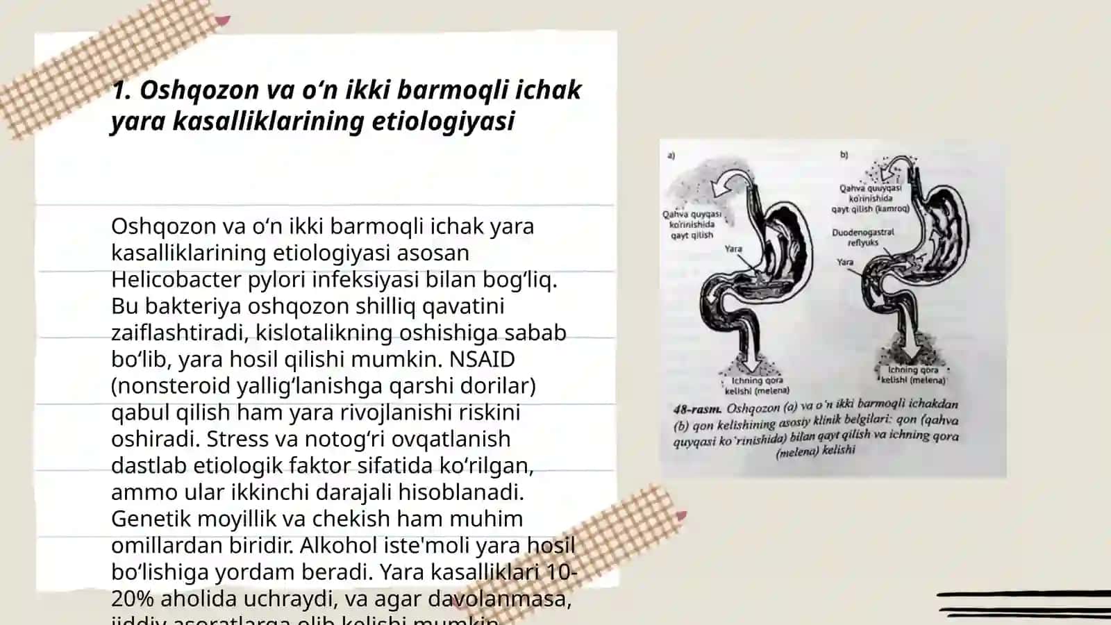 Oshqazon va oʻn ikki barmoqli ichak yara kasalliklari asoratlari va diagnostikasi 3