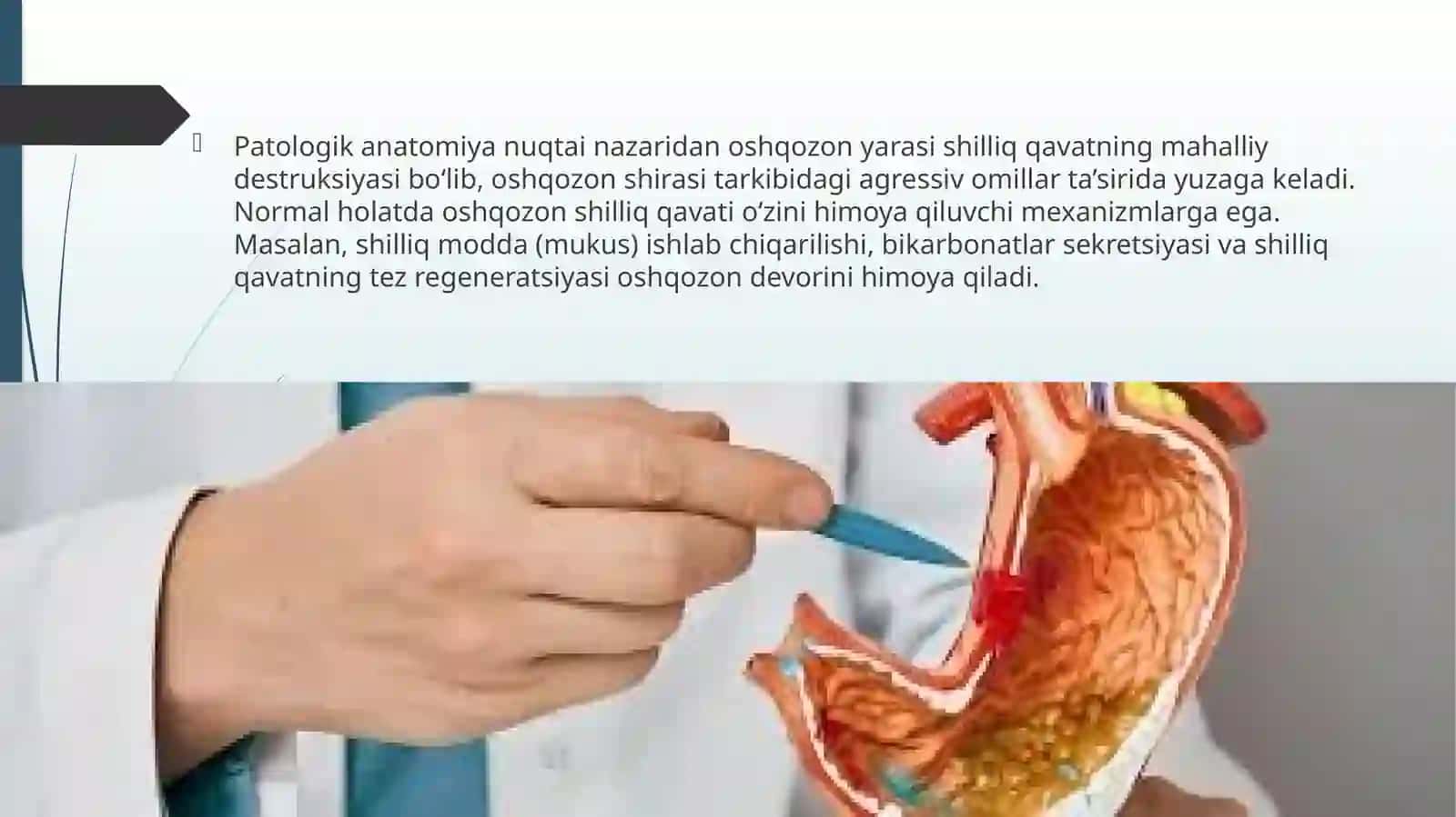 Oshqozon yarasi kasalligi etiopatogenezi 3