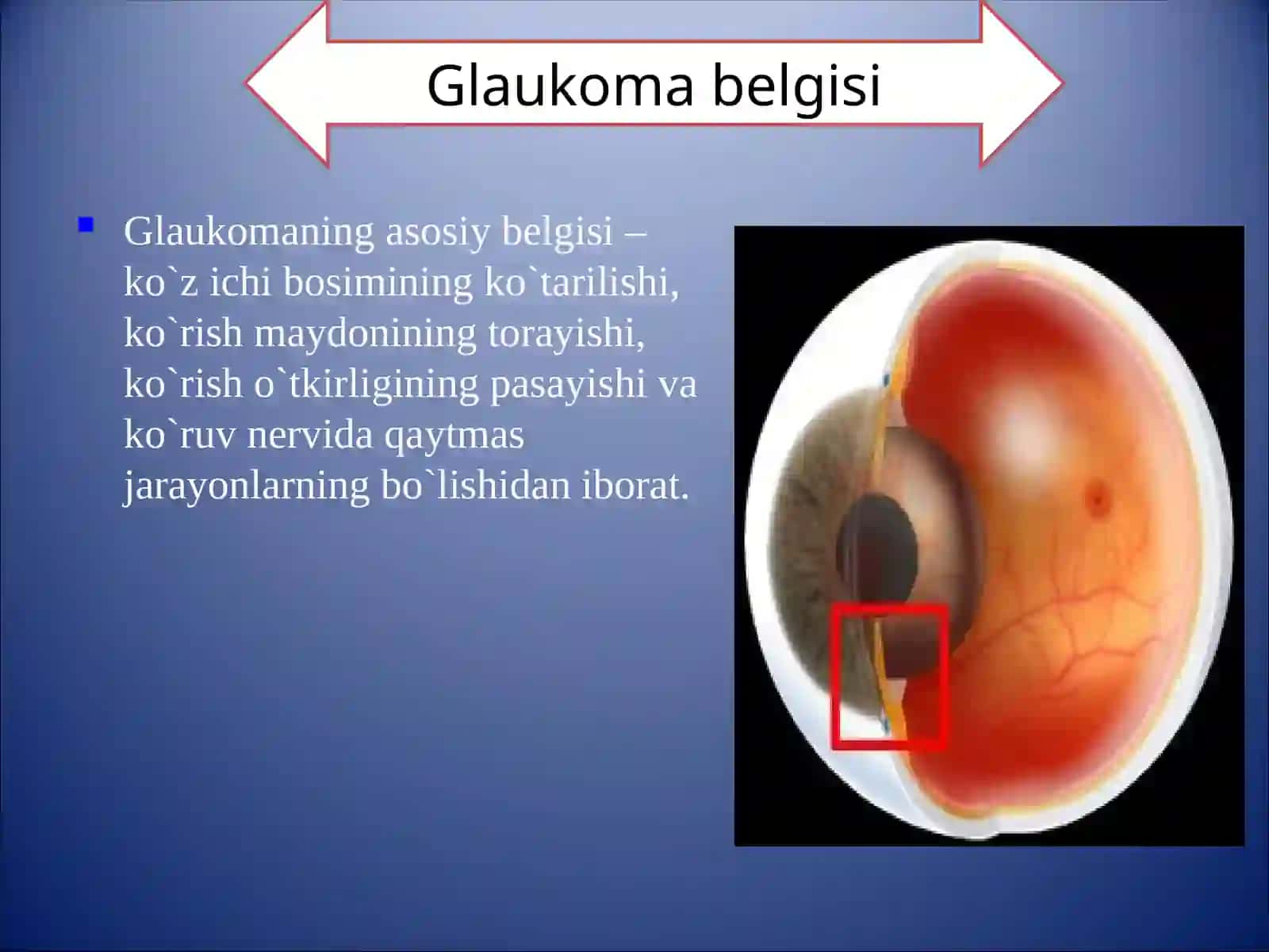 GLAUKOMA 3