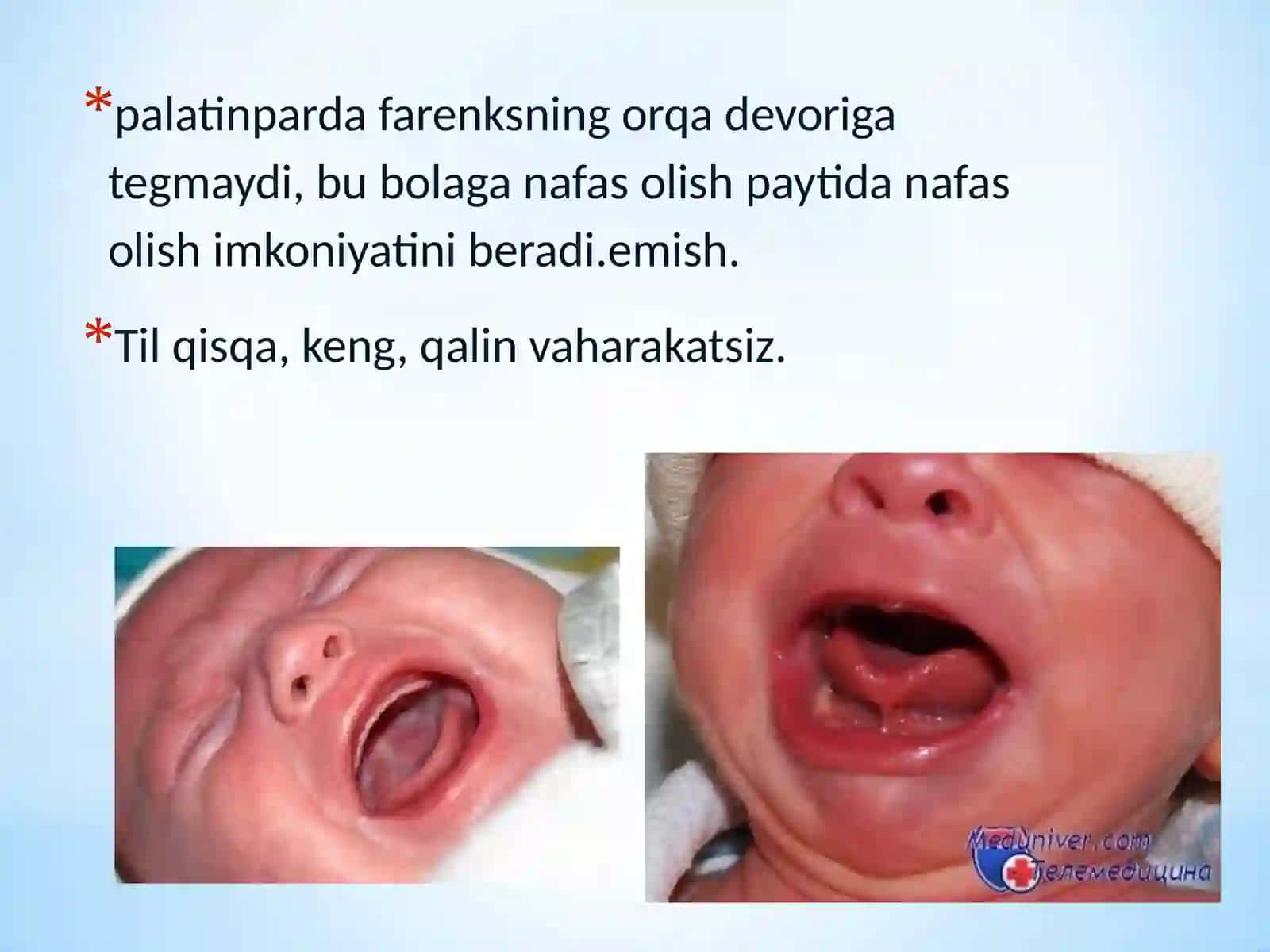 Bolalarda ovqat hazm qilish tizimining anatomik va fiziologik xususiyatlari 3