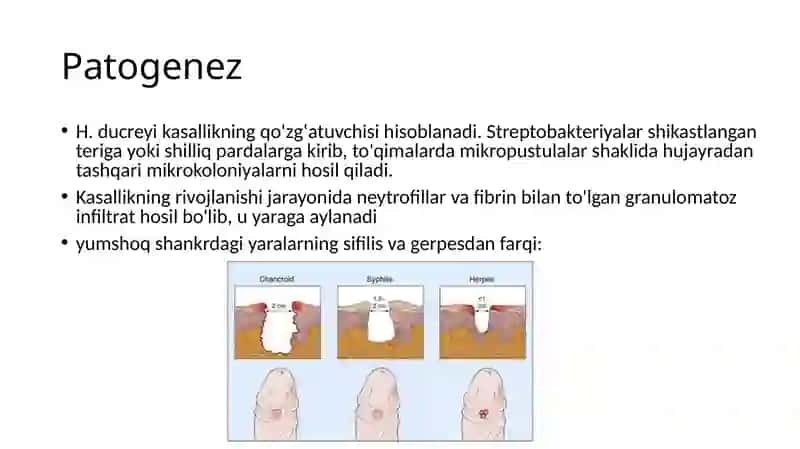 Gulomov Latifning Dermatovenerologiya fanidan Mustaqilishi 3