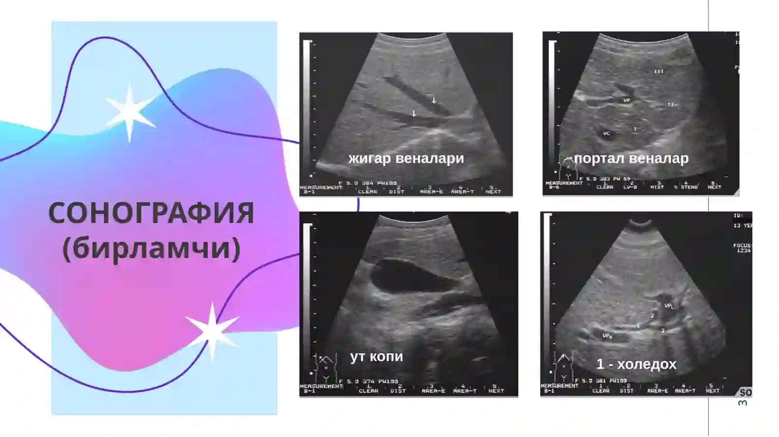 Жигар ва ўт йўллари касалликларини нур ташхисоти 3