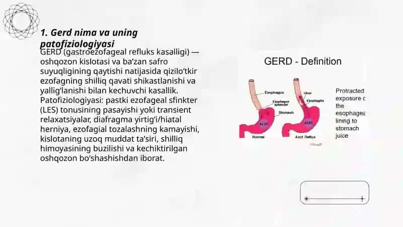 Gerd kasalligi va uni davolanishi 3