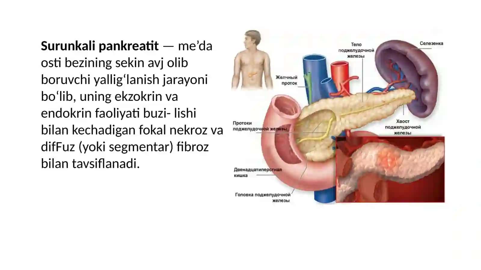 Pankreatit haqida ma’lumot 3