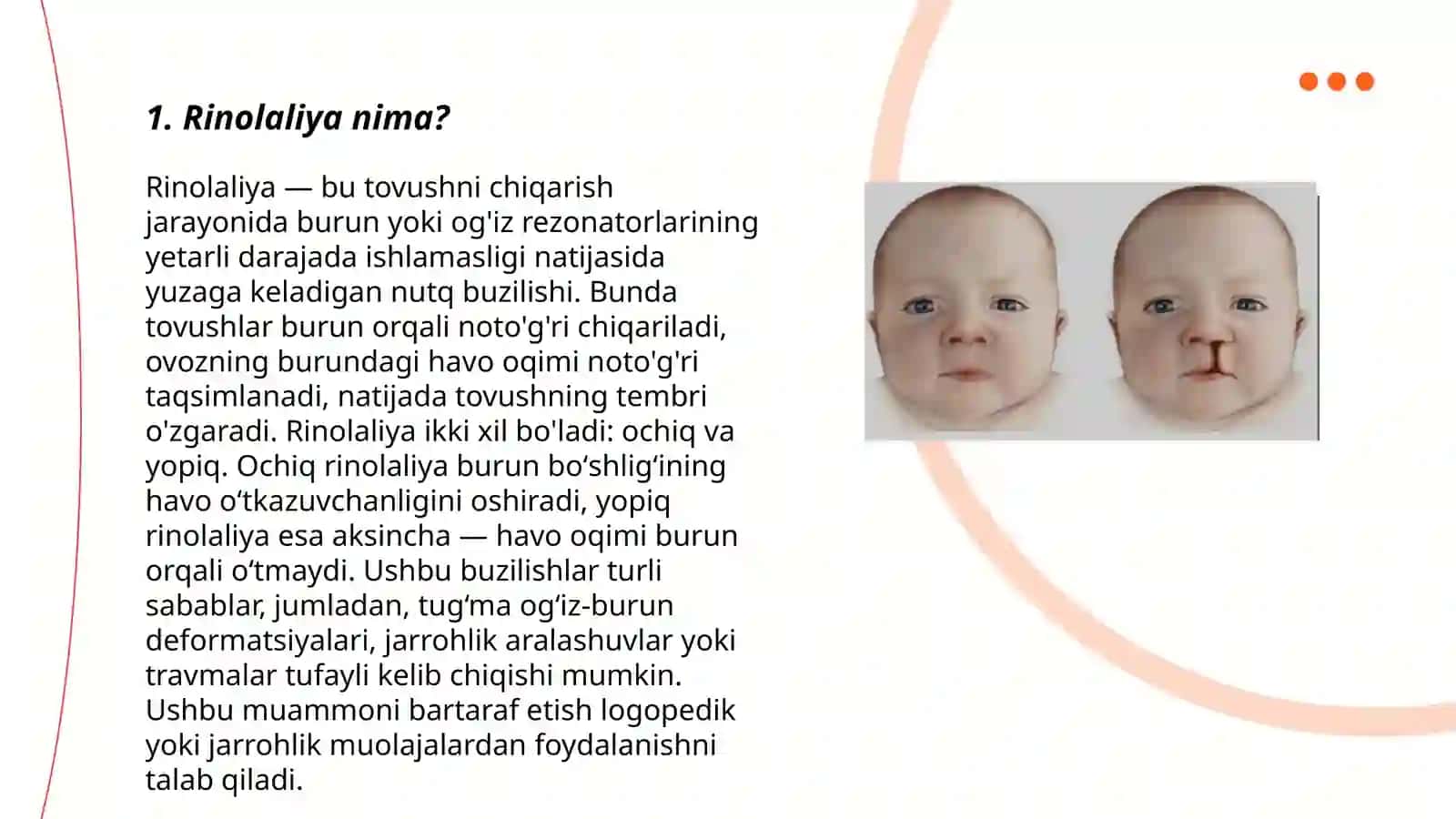 Rinolaliyaning asosiy sabablari 3