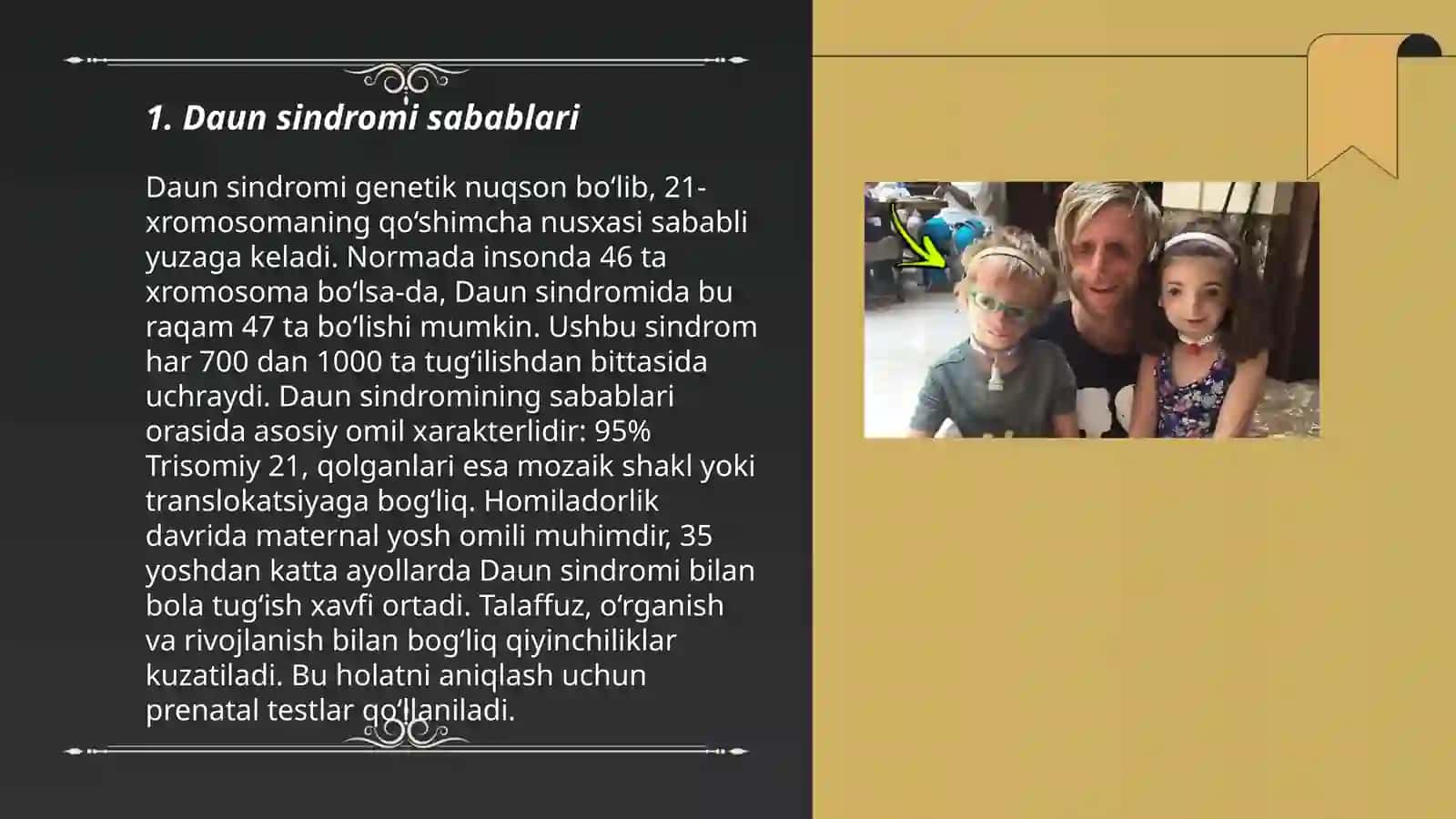 Daun sindromi, Klaynfelter sindromi va Shereshevskiy-Terner sindrom 3