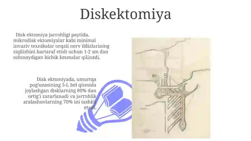 Umurtqa pog'onasi Patologiyalarini operativ davolash usullari. Klinik Anatomiya 3