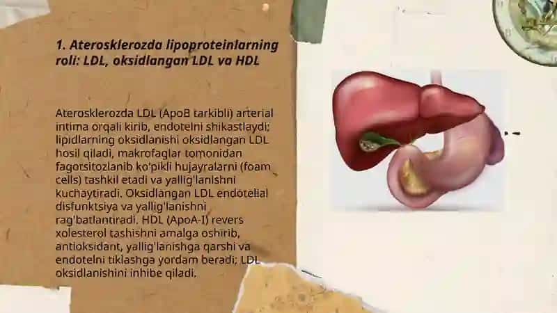 Ateroskleroz rivojlanishining biokimyoviy asoslari. O't-tosh kasalliklari 3