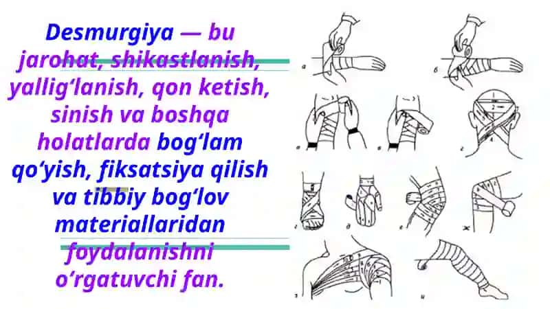 Desmurgiya. Bogʻlam turlari. Zamonaviy jarohat qoplamlari 3
