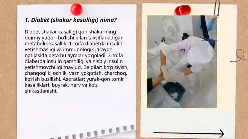 Diabet. Saxir kasalligi va uning alomatlari 3