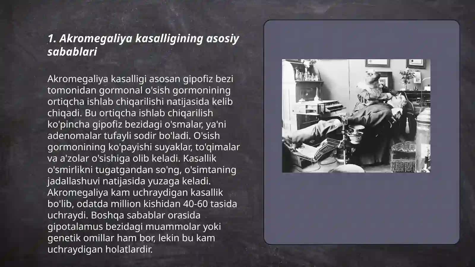 Bolalarda Akromegaliya kasalligi etiologiyasi, potogenizi 3