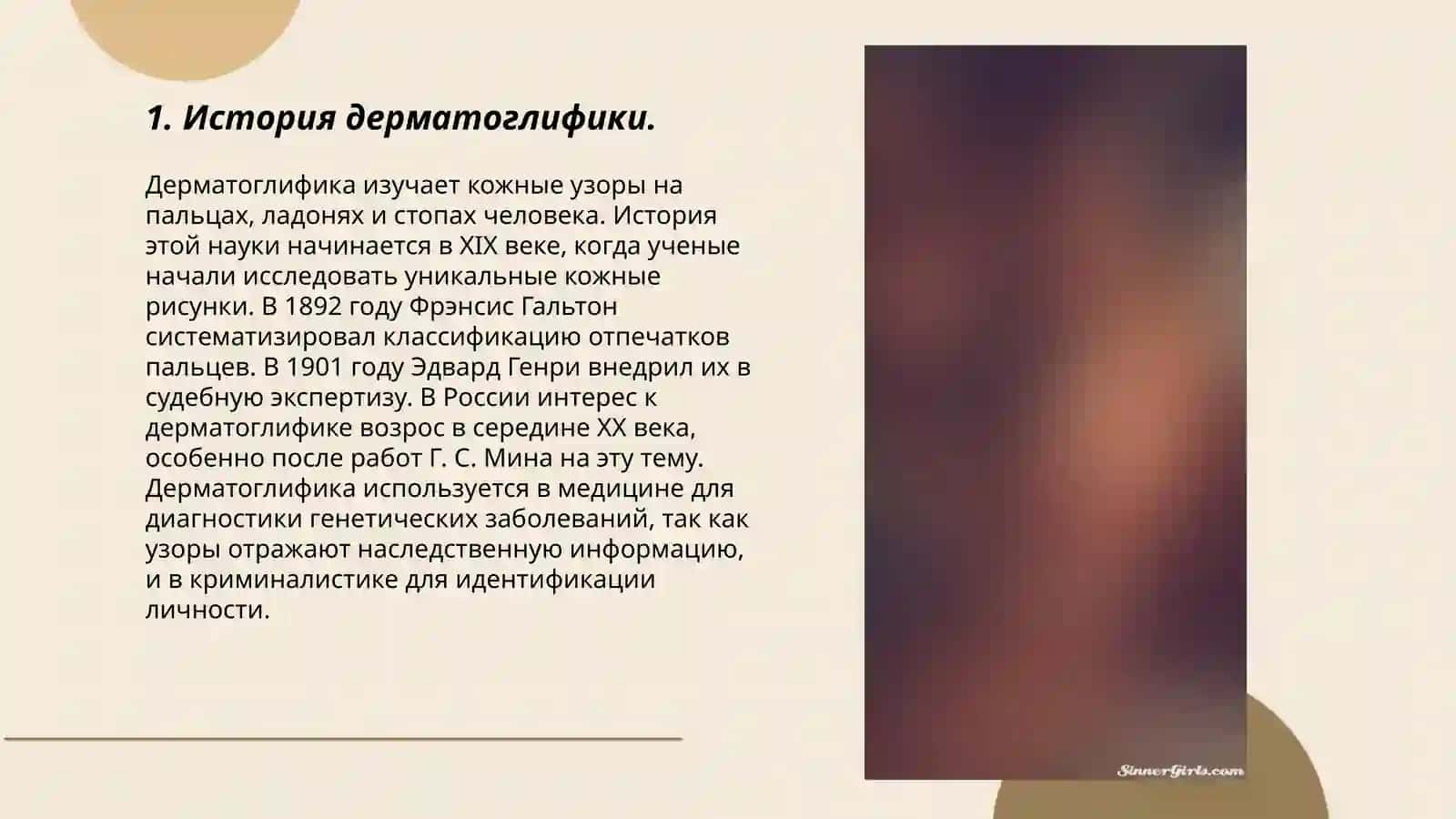 Дерматоглифика. Дактилоскопия. Дерматоглифические показатели (изменения) при различных наследственных болезней 3