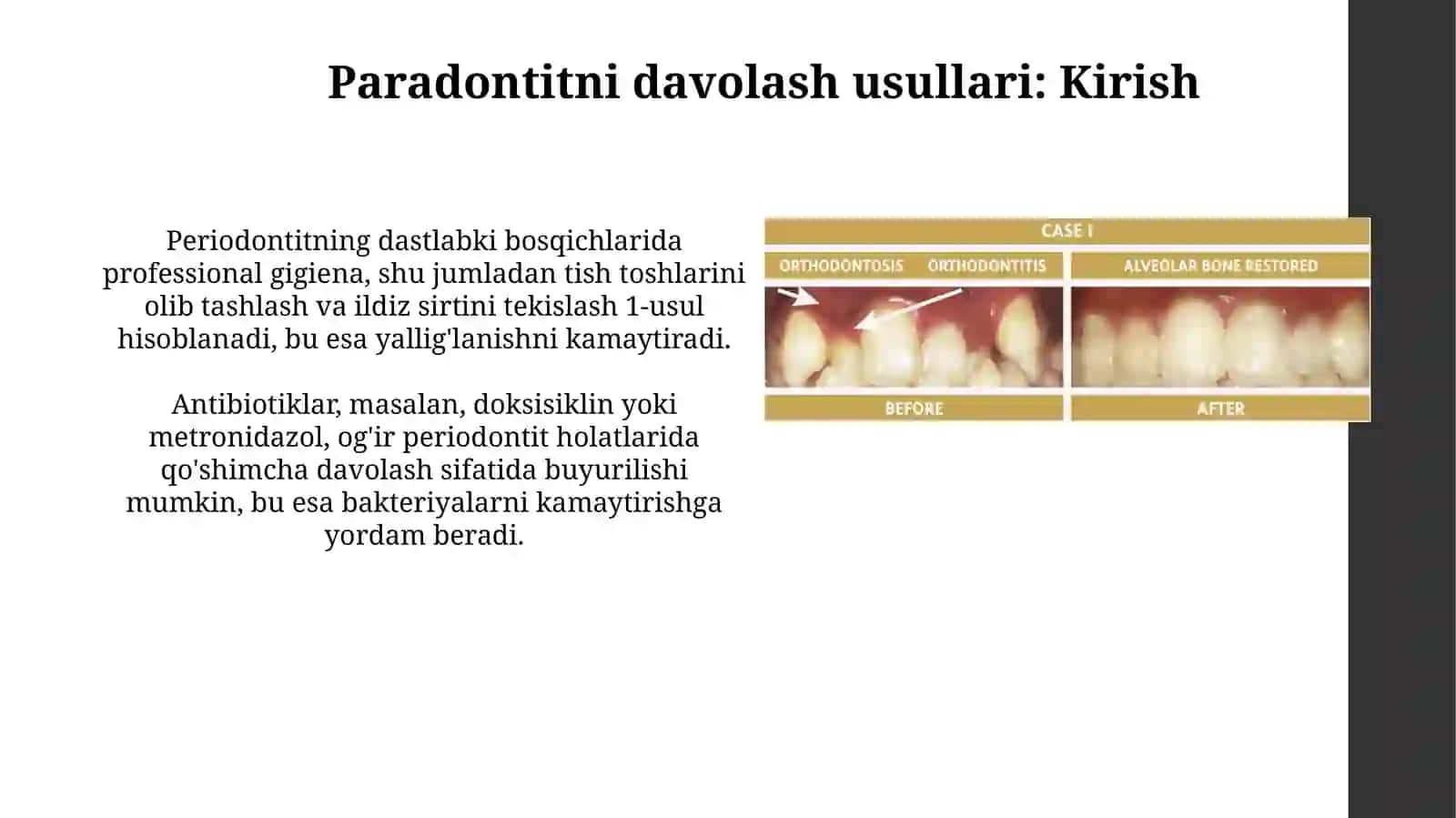 Paradontitlarni jarrohlik yoli bilan davolash usullari. Prikuslarni togirlash usullari 3