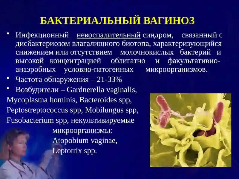 СПЕЦИФИЧЕСКИЕ ВОСПАЛИТЕЛЬНЫЕ ЗАБОЛЕВАНИЯ ЖЕНСКИХ ПОЛОВЫХ ОРГАНОВ 3