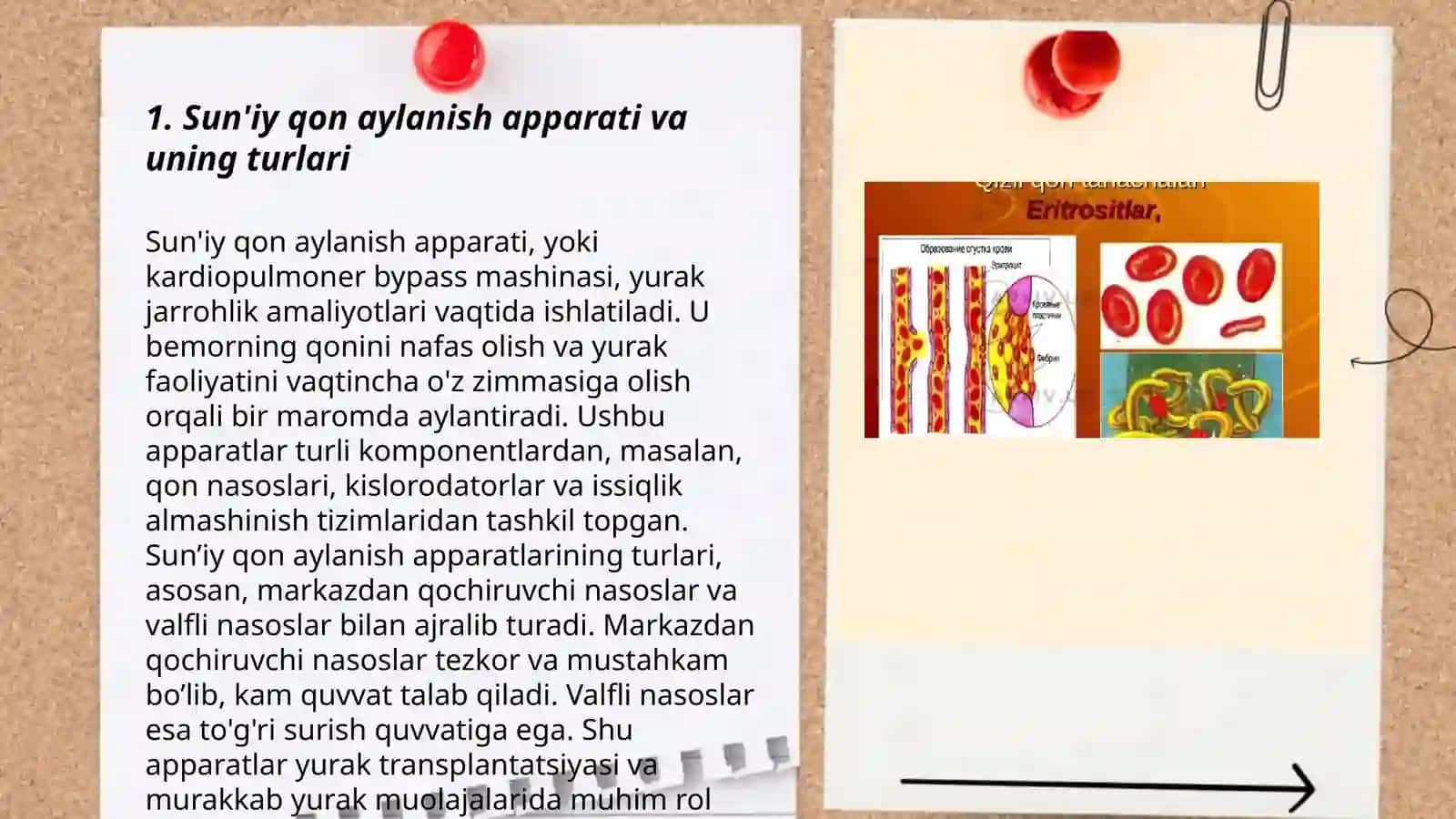Sun'iy qon aylanish apparati va uning turlari 3