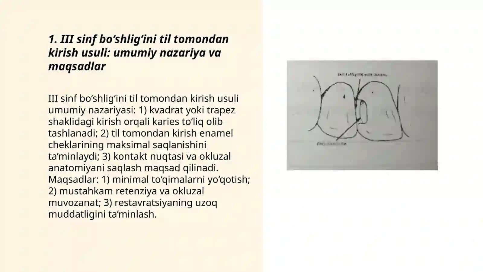 III sinf karies bo‘shlig‘ini charxlash til tomondan kirish usuli 3
