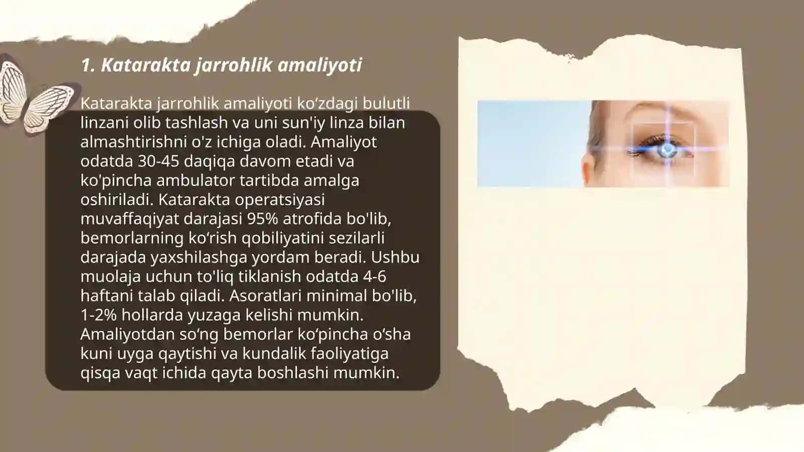 Katarakta jarrohlik amaliyoti 3