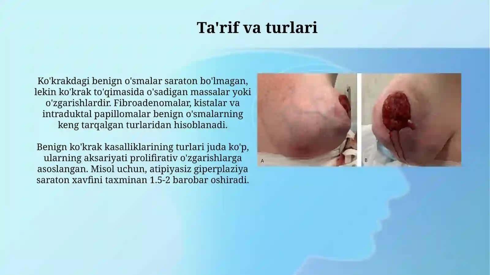 Ko'krak bezi havfsiz o'smalari 3