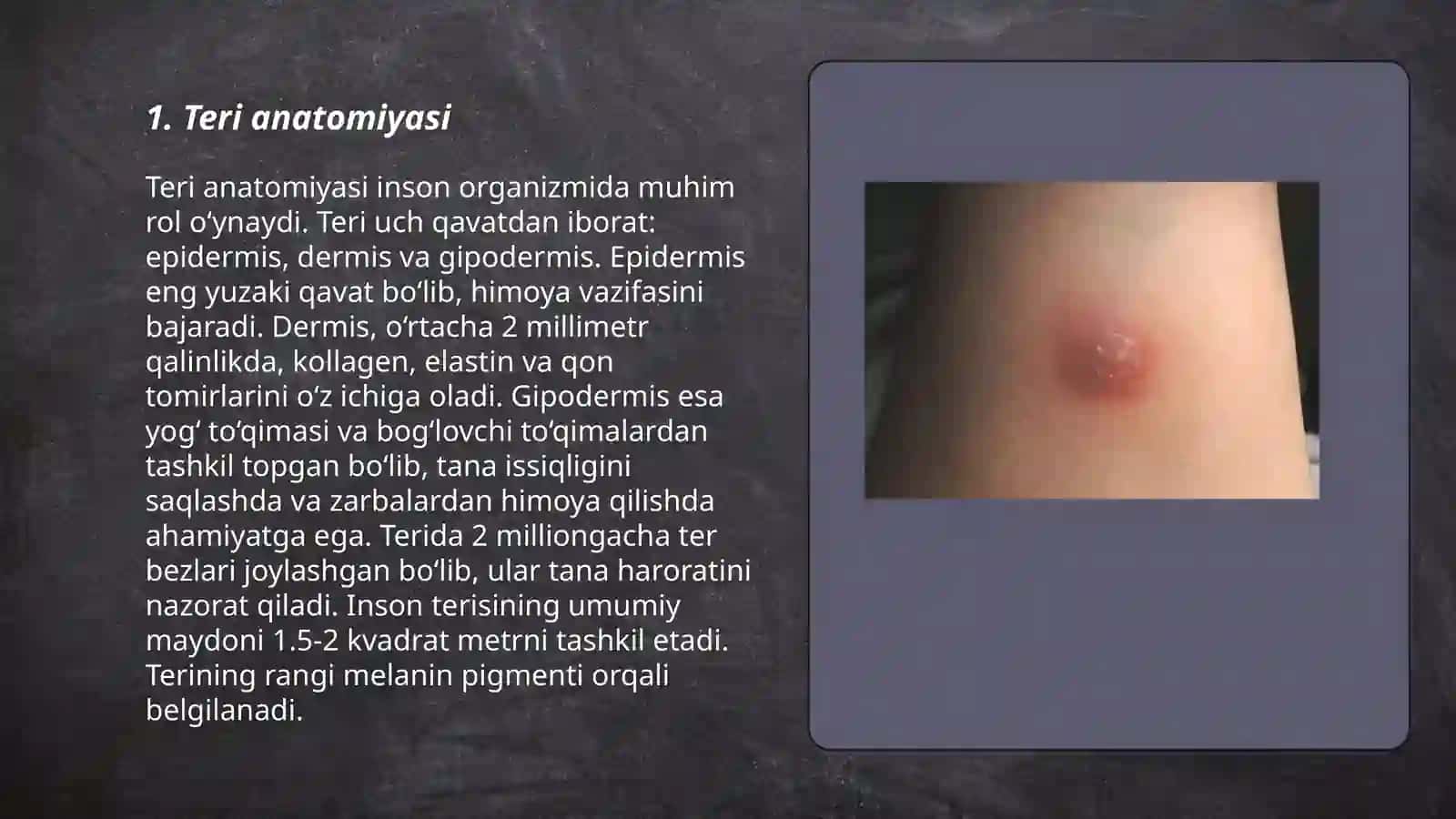 Teri hastaliklar patofiziologiyasi, teri struktur va funksional xususiyatlari, teri toshmalar va ular bilan bog’liq o’zgarishlar 3