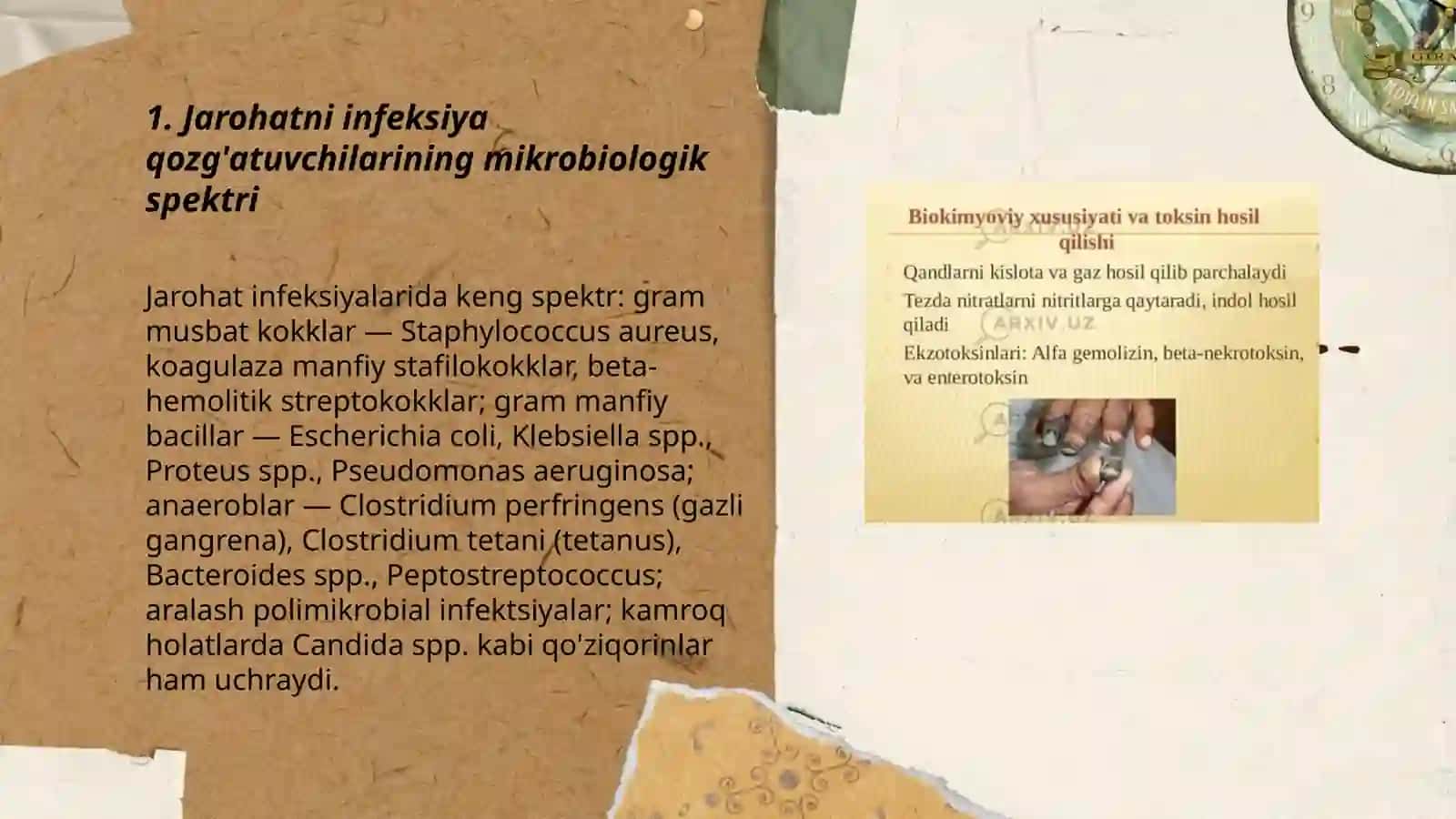 Jarohatni infeksiya qozg'atuvchilari gazli gangrena qoq shol kasalliklarini labaratoriya tashxislari 3