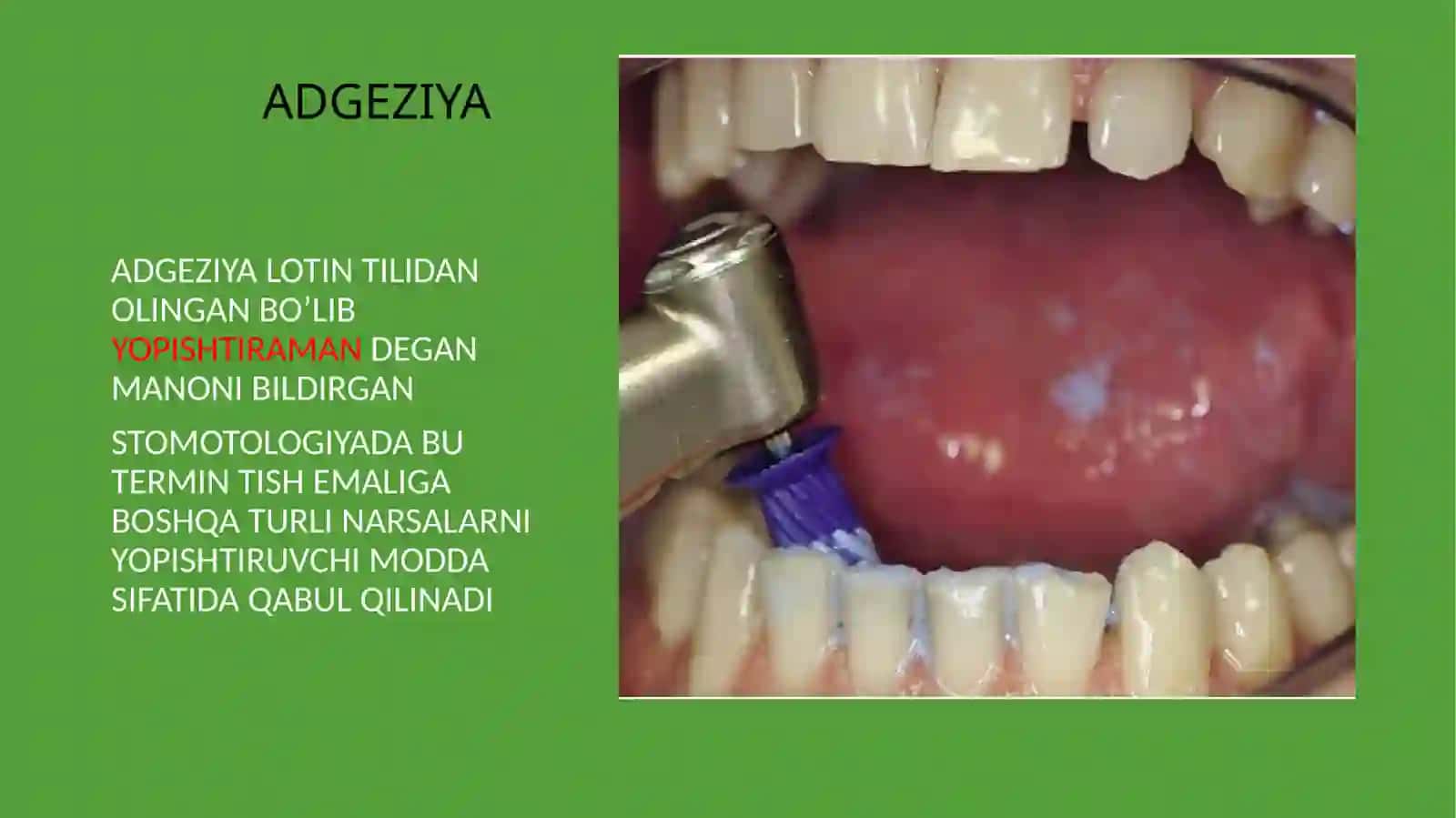 ZAMONAVIY ADGEZIV SISTEMA KILINIK STOMOTOLOGIYADA 3