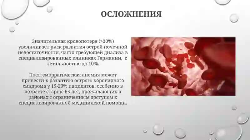 Острый постгеморрагически аннмия 3
