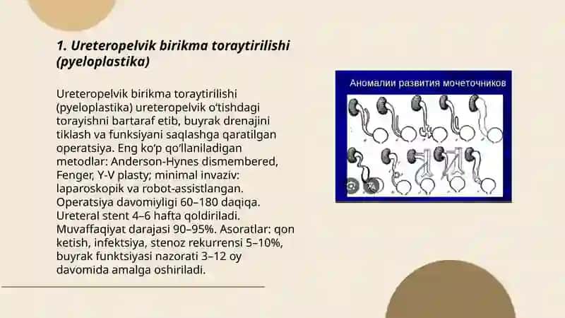 Ureteropelvik birikma toraytirilishi (pyeloplastika) 3
