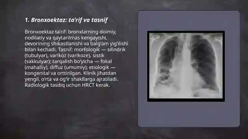 Bronxoektaz 3