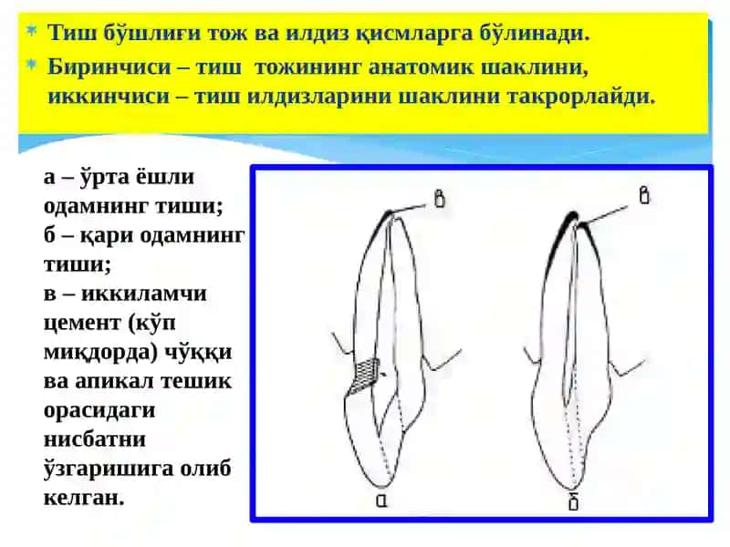 Тишлар морфологияси, тиш бўшлиғи ва илдиз каналларга кириш 3