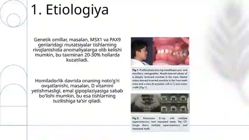 Prikus va tishlarning rivojlanishida uchraydigan anomaliyalar 3