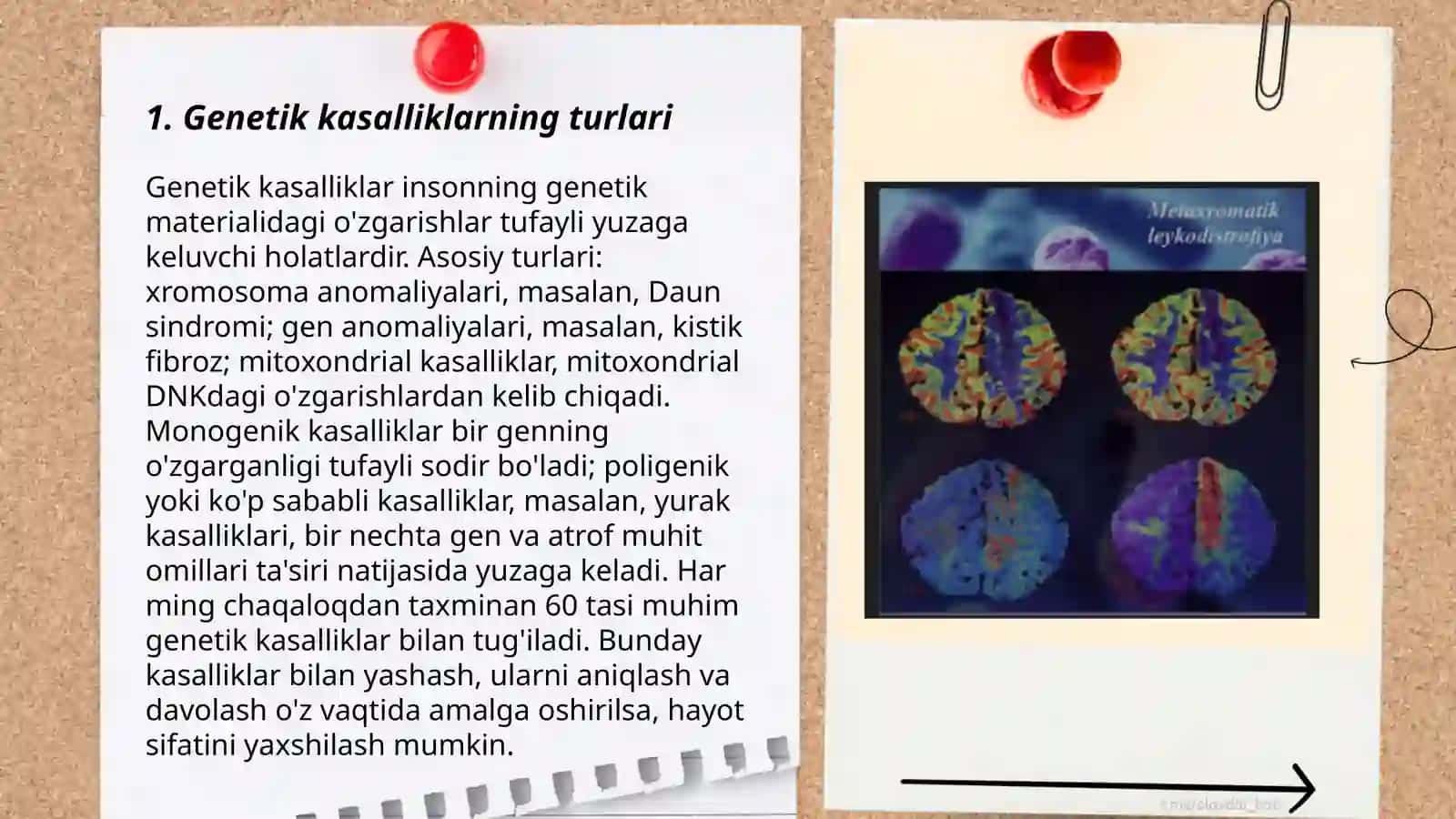 Gen kasalliklari.Odamlarda normal va patalogik belgilarining irsiylanishi 3