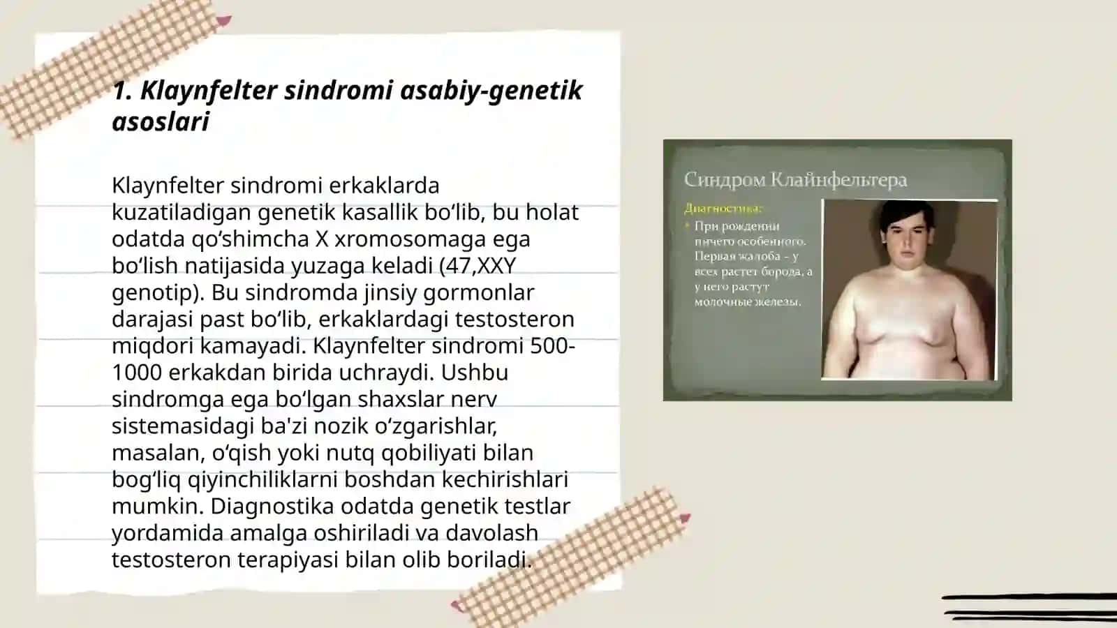 Klyenfelter etiopatogenezi tasnifi klinikasi diagnostika va davolashi 3