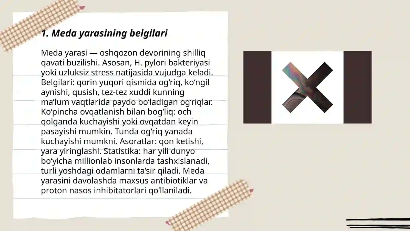 Meda va o'n ikki barmoq ichakning yara kasalligi 3