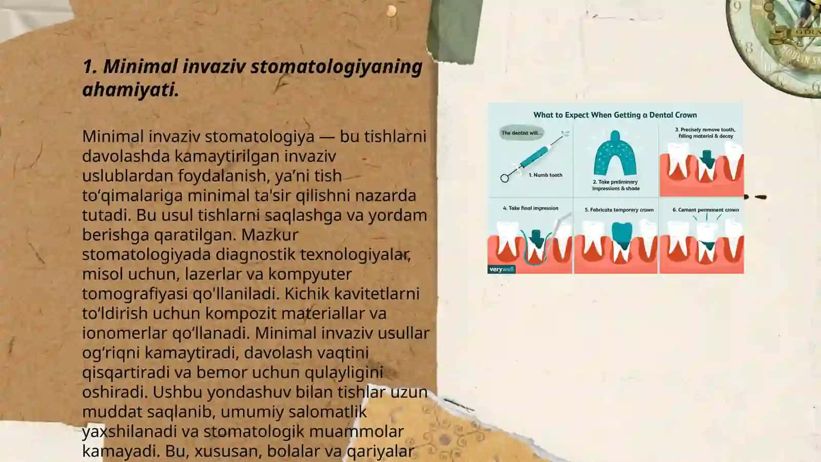 Minimal invaziv stomatologiya 3