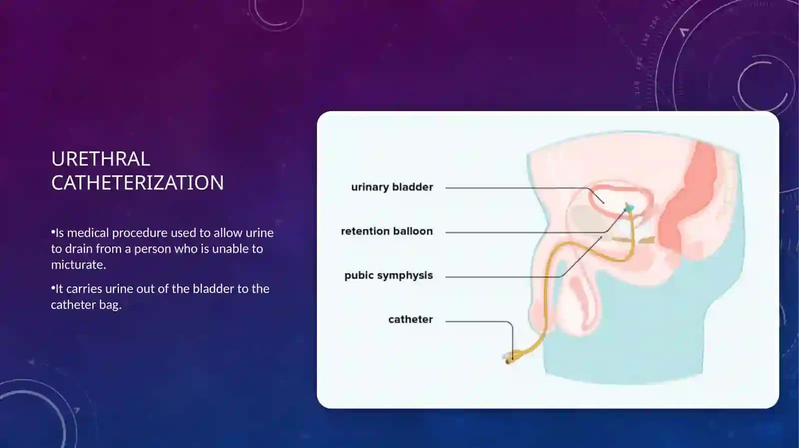 Urethral catheterization 3