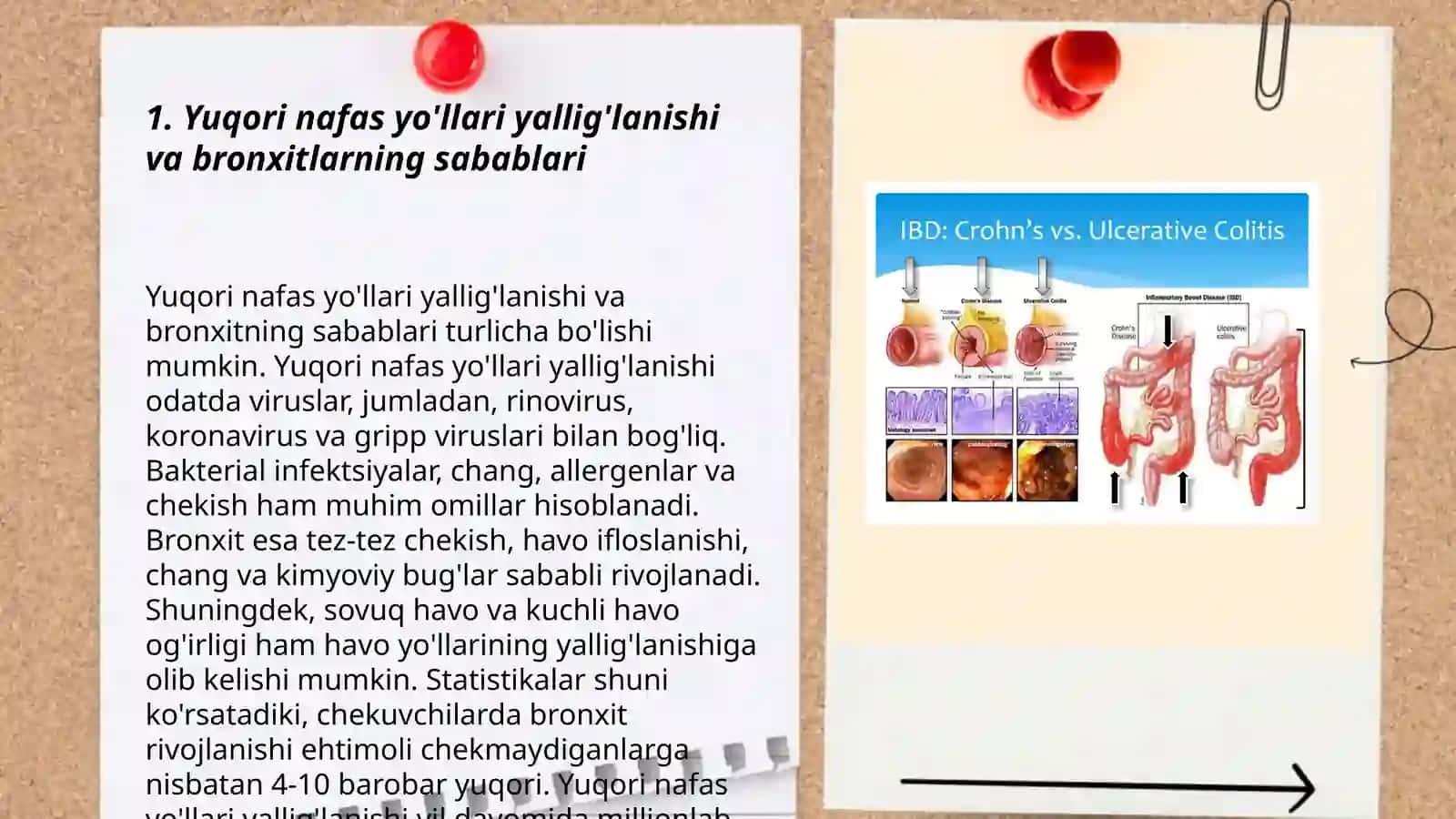 Yuqori nafas yo'llari yallig'lanish kasalliklarida (bronxitlar) Farmatsevtik yordam tamoyillari 3