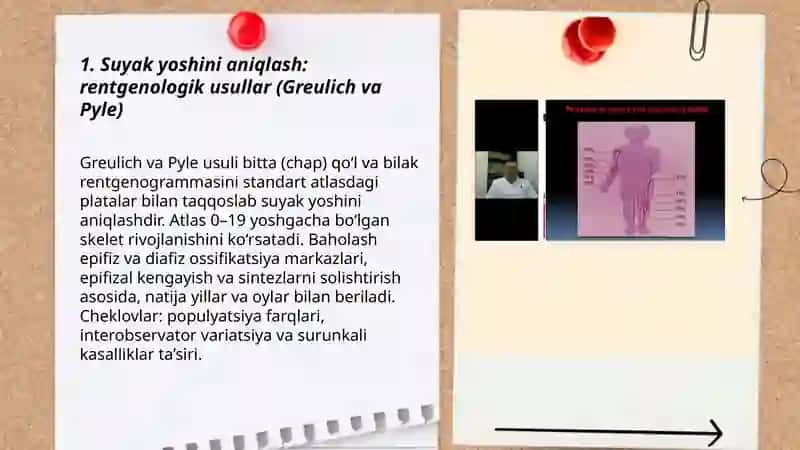 Suyaklarga qarab yoshni baholash usuli 3