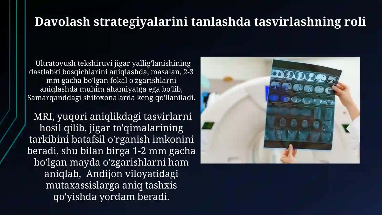 Jigar yalligʻlanishi:uzi, kt,mrt tekshiruvi 3